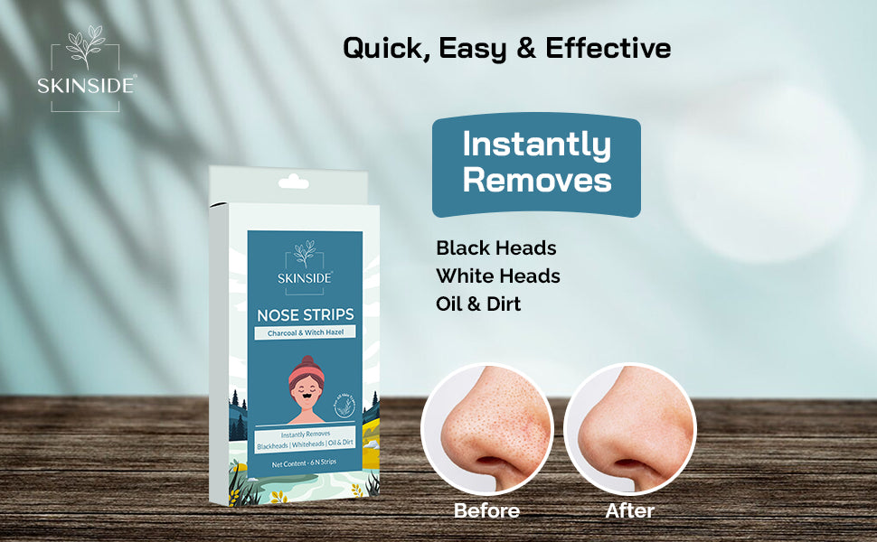 Blackhead Remover Nose Strips - skinside