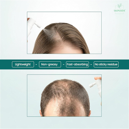Hair Growth Combo(Rosemary Spray+ Hair Serum)