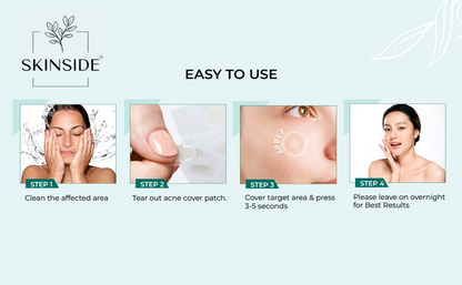 Acne Pimple Patches - skinside